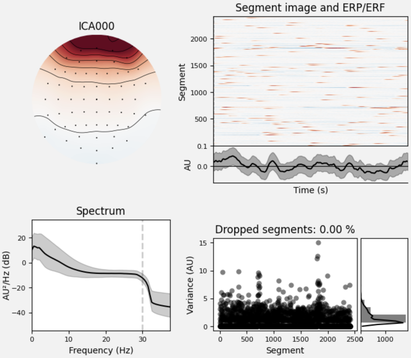 eeg2tempi